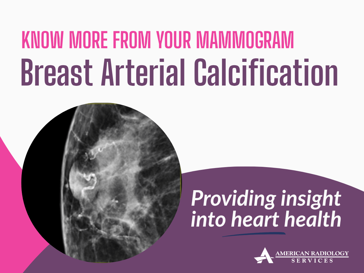 Reporting for Breast Arterial Calcifications