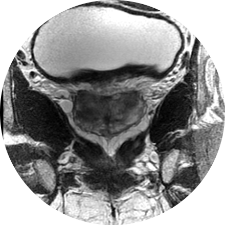 Prostate Imaging Image