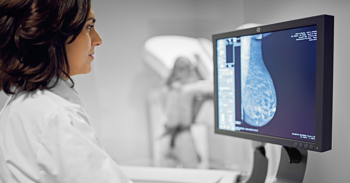 What You Need to Know About Dense Breasts