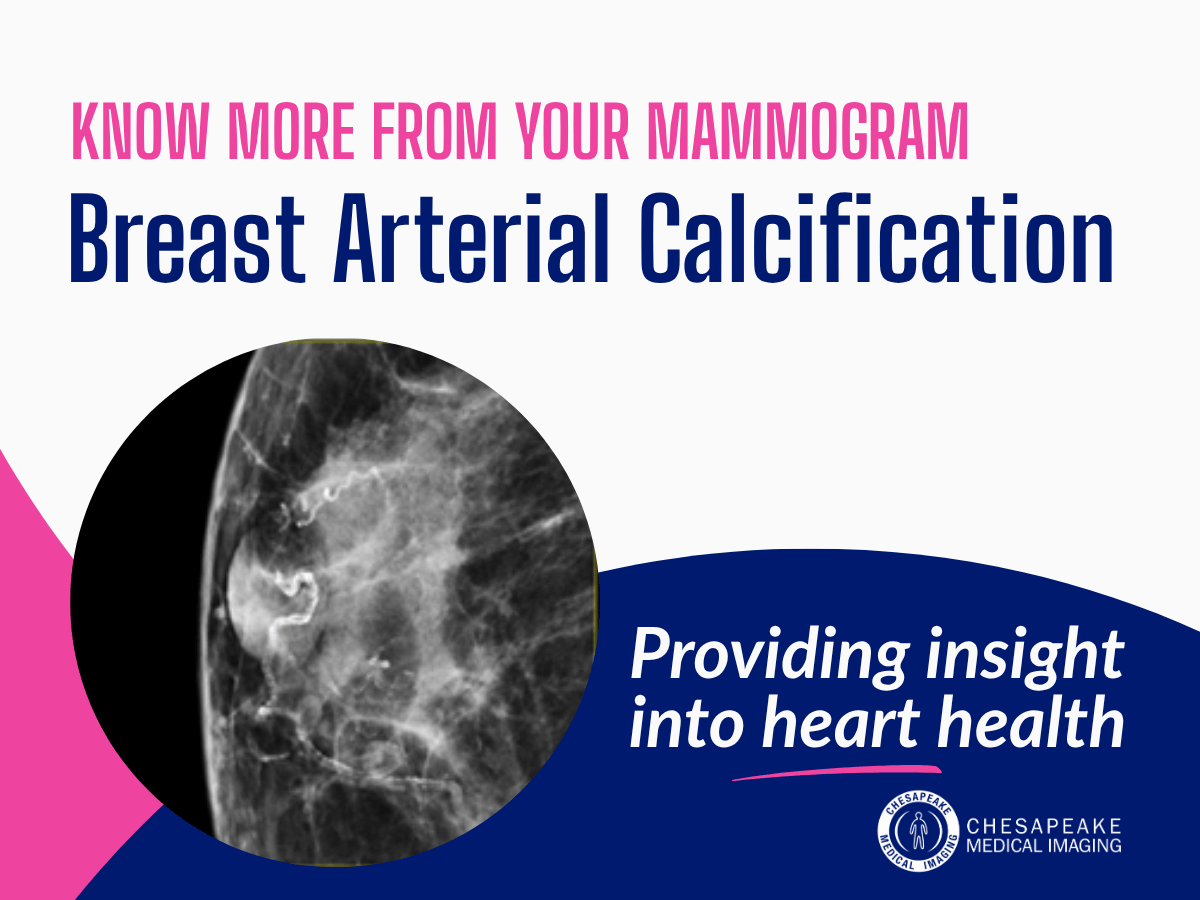 Reporting for Breast Arterial Calcifications