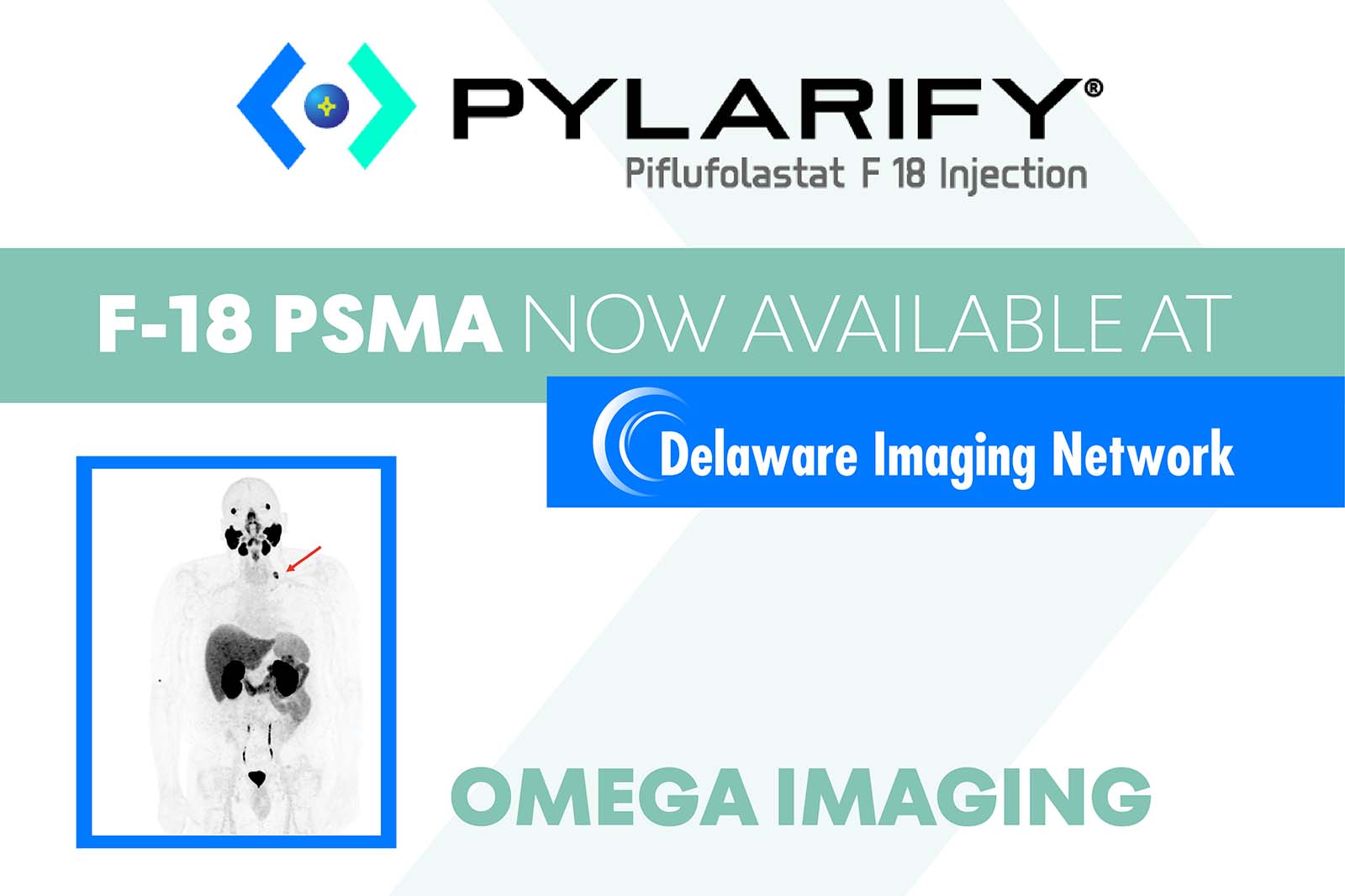 Delaware Imaging Network now offering F-18 PSMA PET/CT 