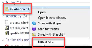 Right-click menu — Extract All