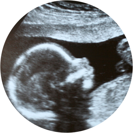 Maternal Fetal Imaging Image