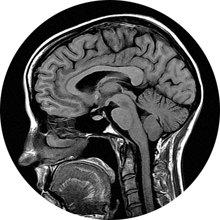 MRI Image