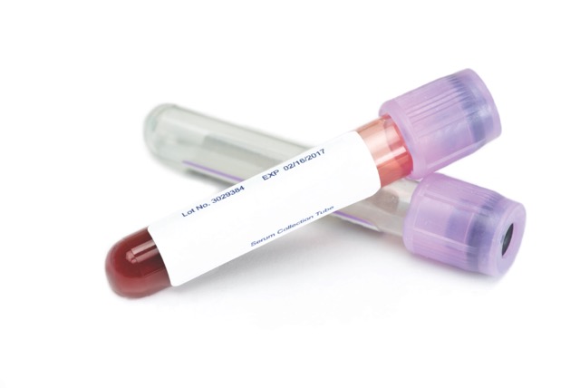 Safest Contrast Agents