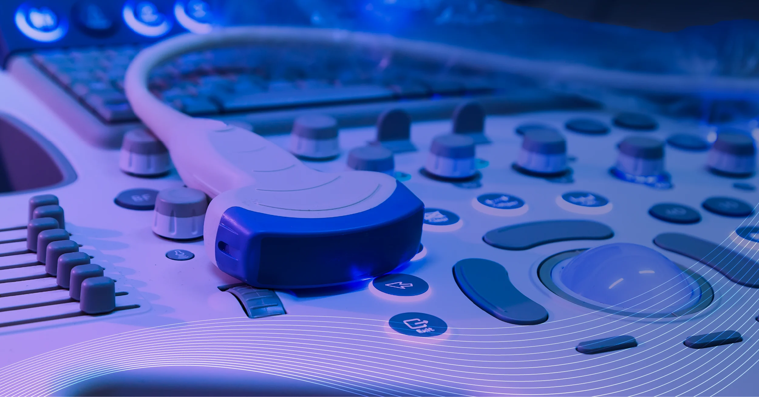 how is AI used in ultrasound, AI in ultrasound