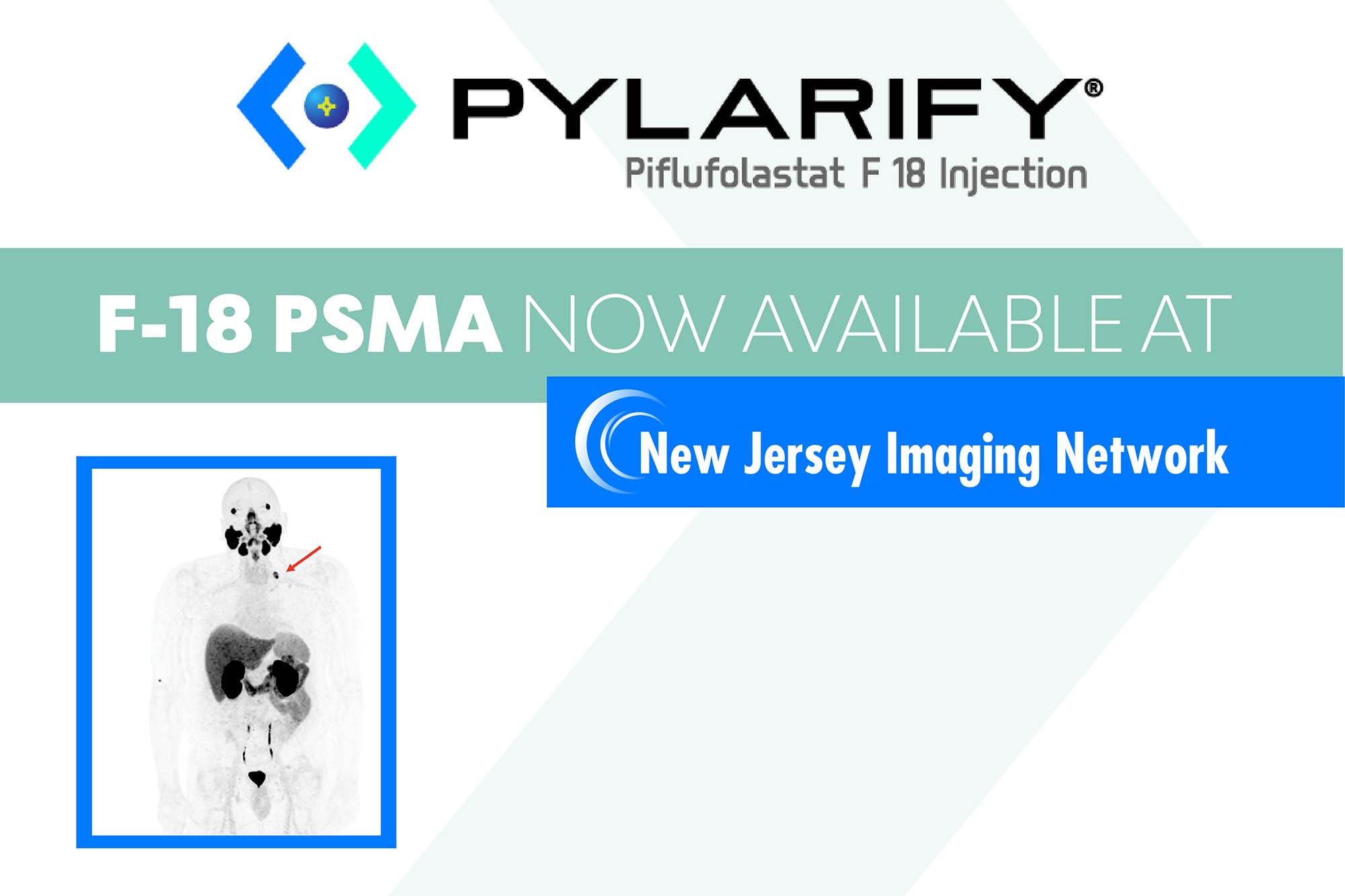 F-18 PSMA PET/CT, New Jersey Imaging Network