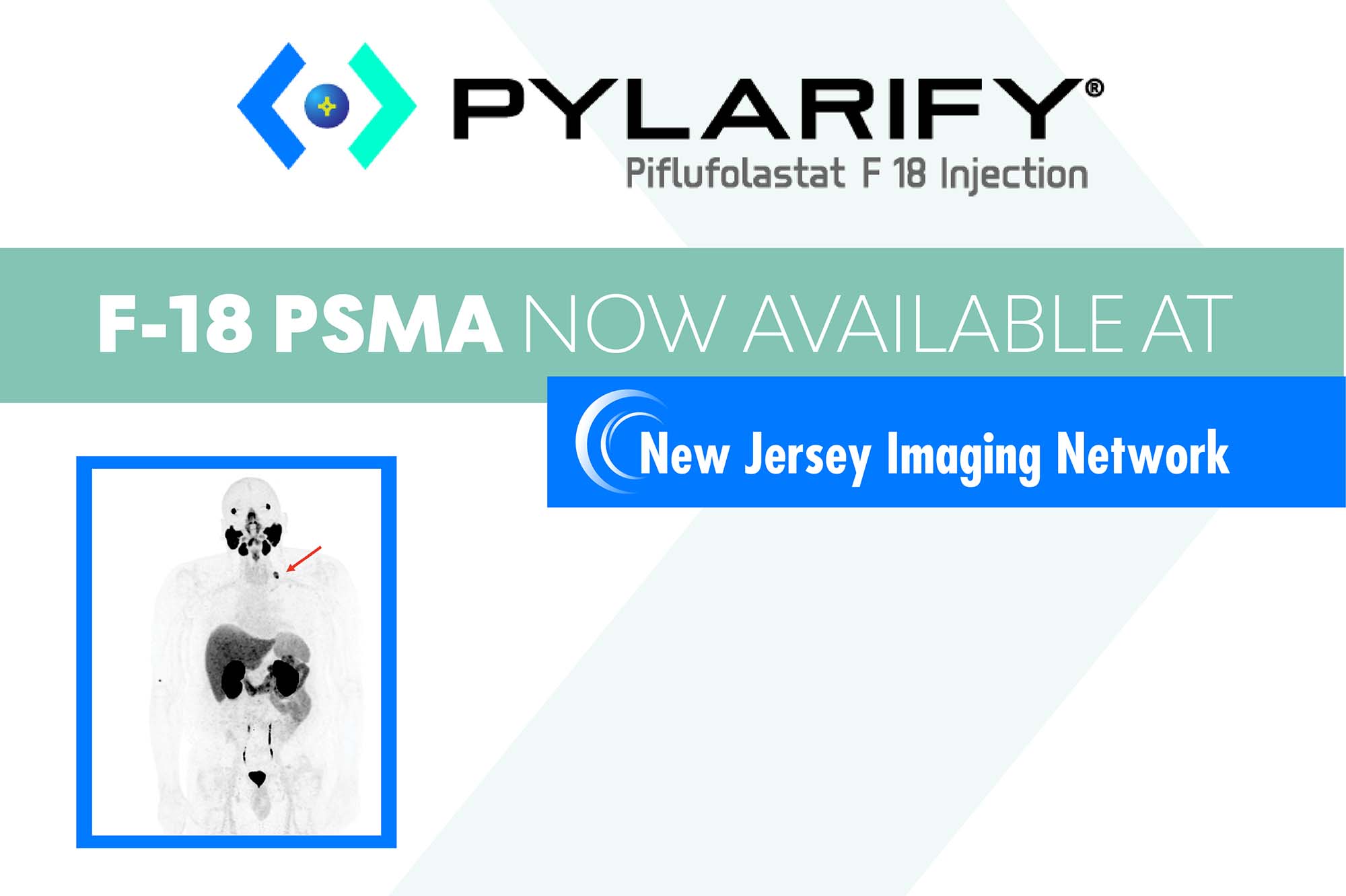  F-18 PSMA PET/CT, New Jersey Imaging Network
