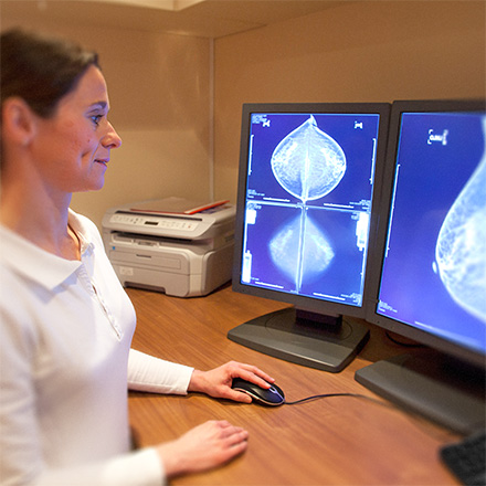 What is a 3D mammogram?