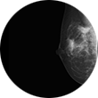 Breast Biopsy Image