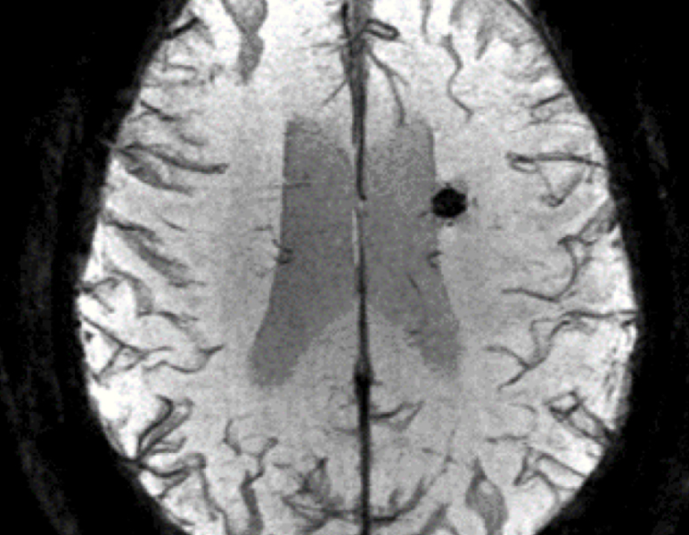 Open MRI Image 2