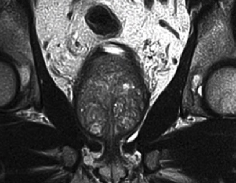 Open MRI Image 5