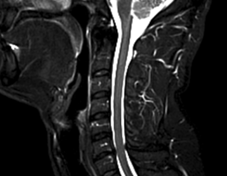 Open MRI Image 6