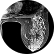 Breast MRI Image