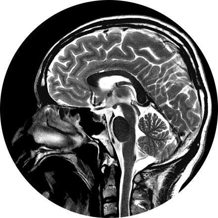 Brain & Spine Imaging Image