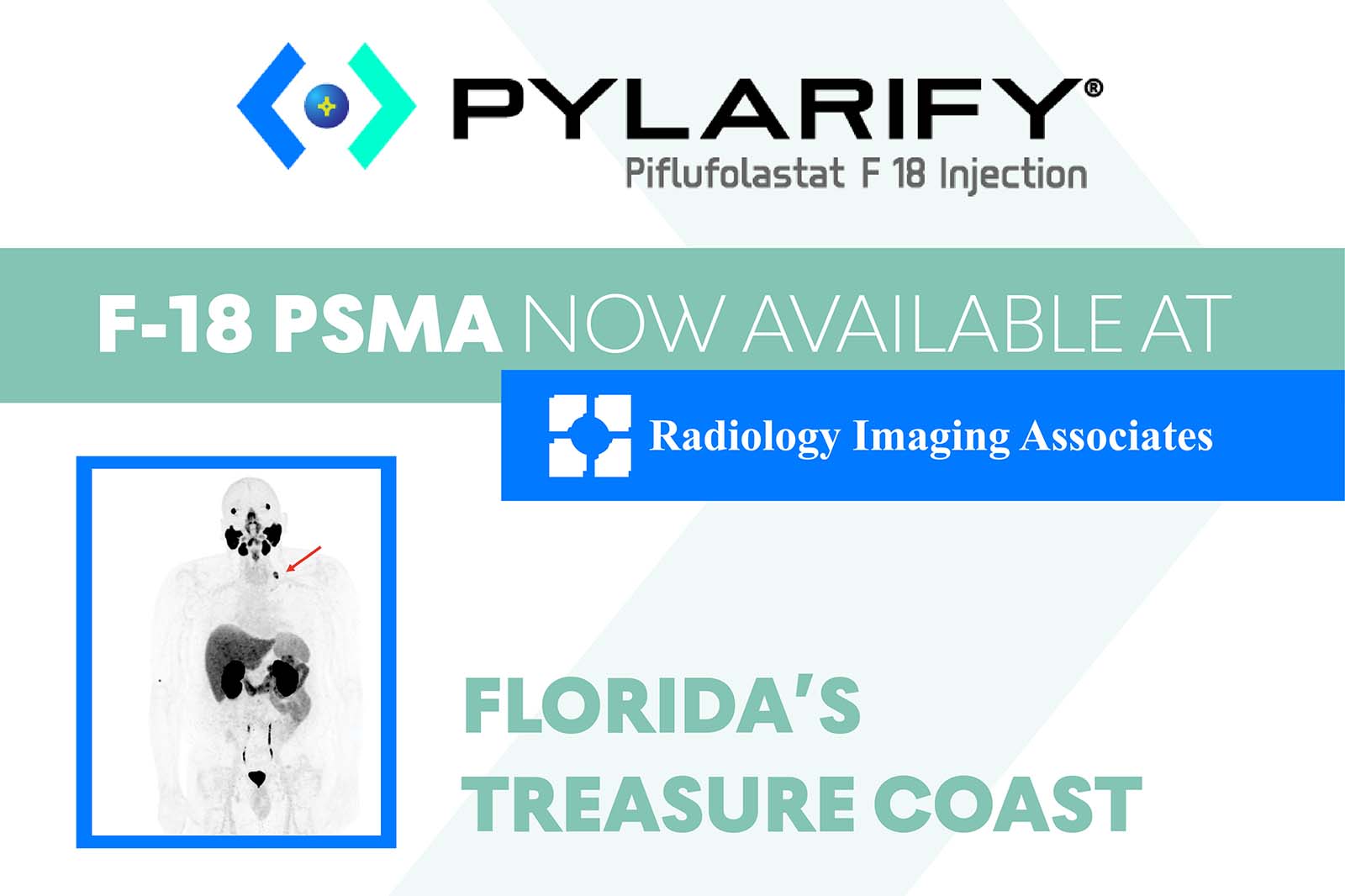  F-18 PSMA PET/CT, Radiology Imaging Associates