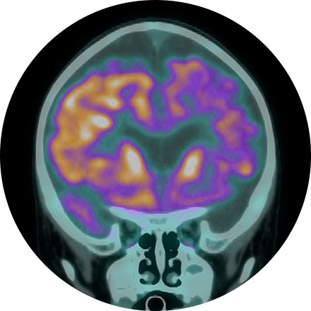 Brain Health Image
