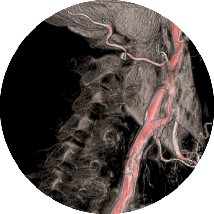 Interventional Radiology Image